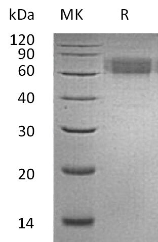 BL-0598NP: Greater than 95% as determined by reducing SDS-PAGE. (QC verified)