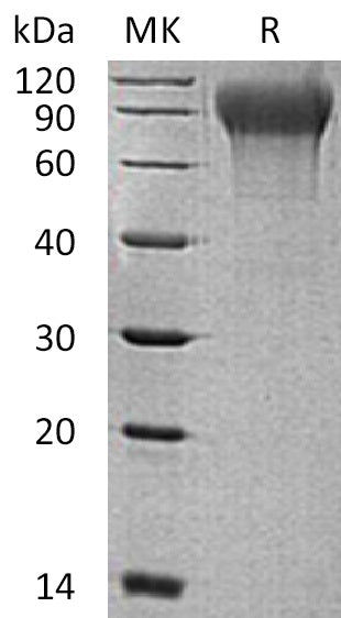 BL-0663NP: Greater than 95% as determined by reducing SDS-PAGE. (QC verified)