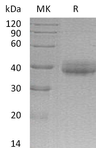 BL-0661NP: Greater than 90% as determined by reducing SDS-PAGE. (QC verified)