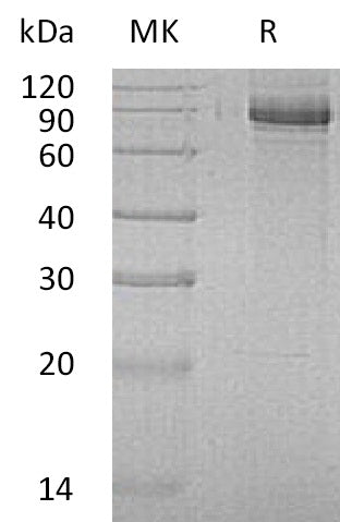 BL-0657NP: Greater than 95% as determined by reducing SDS-PAGE. (QC verified)