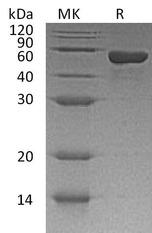 BL-0667NP: Greater than 95% as determined by reducing SDS-PAGE. (QC verified)