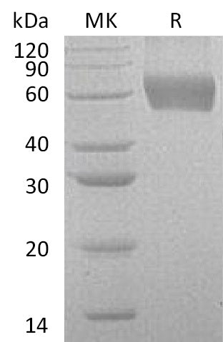 BL-0306NP: Greater than 95% as determined by reducing SDS-PAGE. (QC verified)