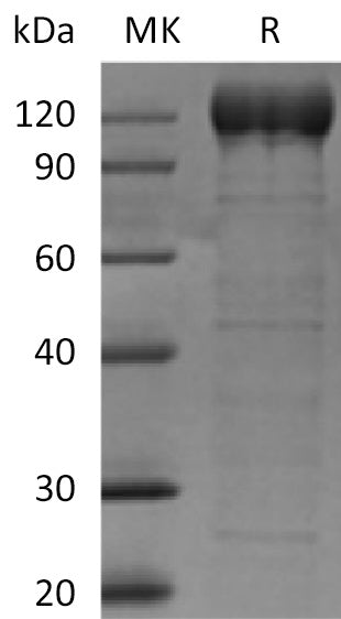 BL-0211NP: Greater than 95% as determined by reducing SDS-PAGE. (QC verified)