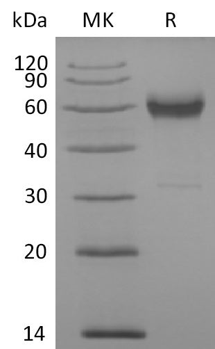 BL-0033NP: Greater than 95% as determined by reducing SDS-PAGE. (QC verified)