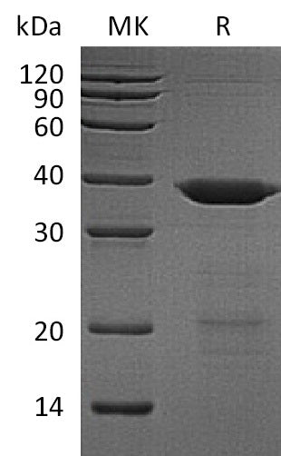 BL-2062NP: Greater than 90% as determined by reducing SDS-PAGE. (QC verified)