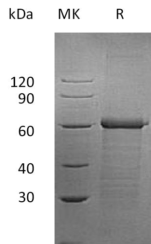 BL-0821NP: Greater than 95% as determined by reducing SDS-PAGE. (QC verified)