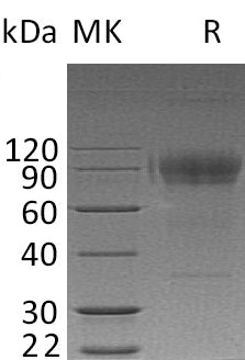 BL-0091NP: Greater than 95% as determined by reducing SDS-PAGE. (QC verified)