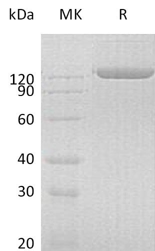 BL-0083NP: Greater than 95% as determined by reducing SDS-PAGE. (QC verified)