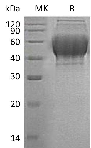 BL-0911NP: Greater than 95% as determined by reducing SDS-PAGE. (QC verified)