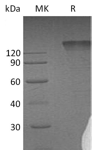 BL-0086NP: Greater than 95% as determined by reducing SDS-PAGE. (QC verified)