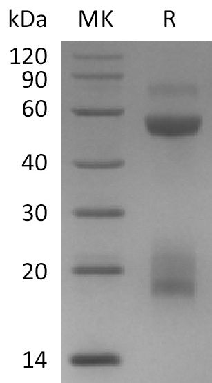 BL-0940NP: Greater than 95% as determined by reducing SDS-PAGE. (QC verified)