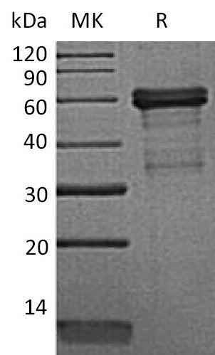 BL-0104NP: Greater than 95% as determined by reducing SDS-PAGE. (QC verified)