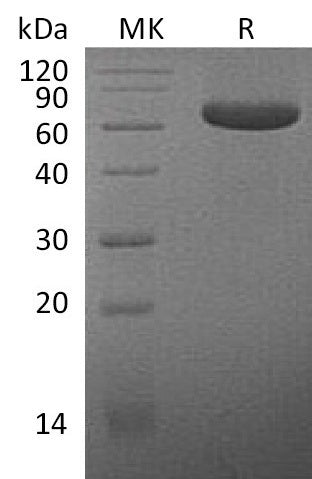 BL-0140NP: Greater than 90% as determined by reducing SDS-PAGE. (QC verified)