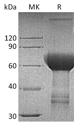 BL-0193NP: Greater than 95% as determined by reducing SDS-PAGE. (QC verified)