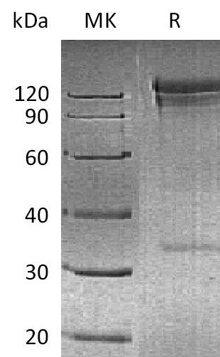 BL-2090NP: Greater than 95% as determined by reducing SDS-PAGE. (QC verified)