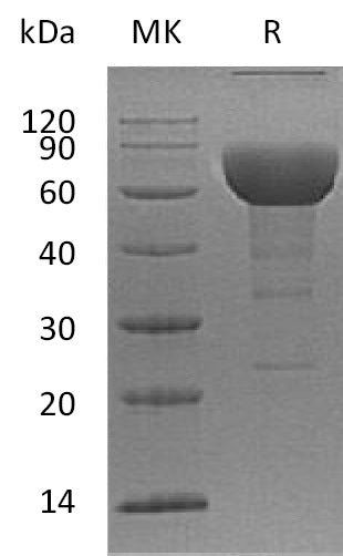 BL-0170NP: Greater than 90% as determined by reducing SDS-PAGE. (QC verified)