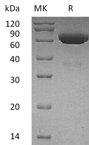 BL-0798NP: Greater than 95% as determined by reducing SDS-PAGE. (QC verified)