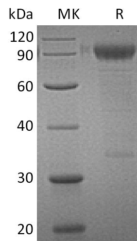 BL-0198NP: Greater than 95% as determined by reducing SDS-PAGE. (QC verified)