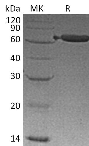 BL-0203NP: Greater than 95% as determined by reducing SDS-PAGE. (QC verified)