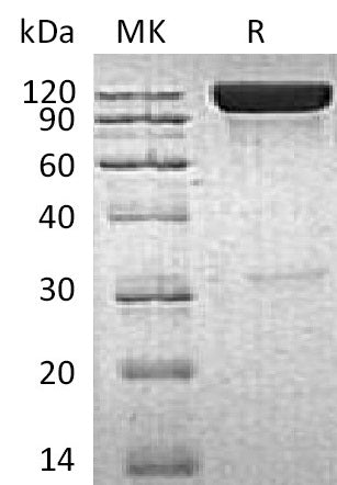 BL-0060NP: Greater than 90% as determined by reducing SDS-PAGE. (QC verified)