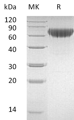 BL-2158NP: Greater than 95% as determined by reducing SDS-PAGE. (QC verified)